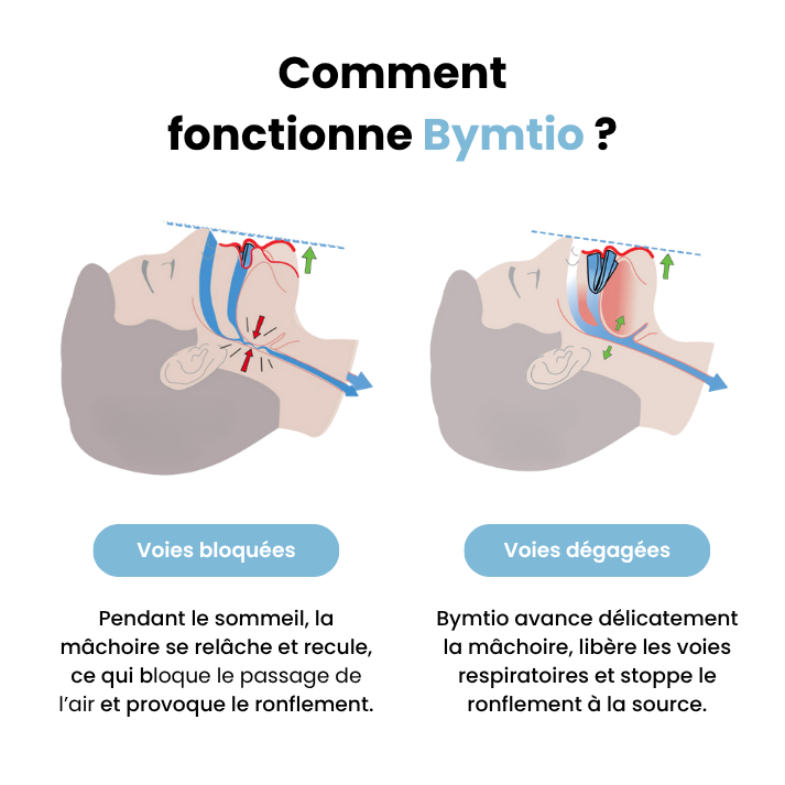 Bymtio|Dispositif Anti-Ronflement